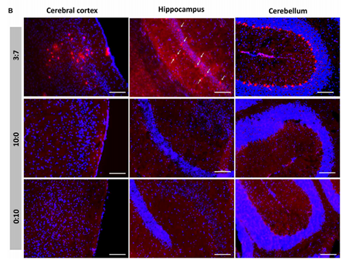 被包裹在含有NT-类脂质的LNP中的Cre重组酶乐成转移。。。。大脑中的转染神经元呈红色高亮。。。。
