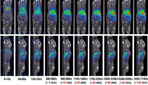 玩彩网PET/CT分子影像手艺平台