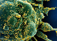 唾液检测新冠抗体新要领来了，，，，获取效果仅需几小时！