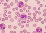 一种神秘颗粒被发明了！它能否成为败血症早筛标记物？？