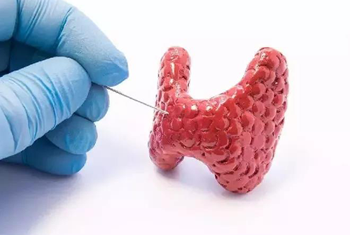 甲状腺疾病，，包括甲状腺功效减退和甲状腺功效亢进，，自古以来就是重复被医学研究职员研究的疾病